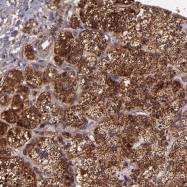 NBP1-85810 - Isocitric dehydrogenase gamma / IDH3G