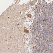 NBP1-85824 - Isocitric dehydrogenase gamma / IDH3G