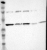 NBP1-85810 - Isocitric dehydrogenase gamma / IDH3G