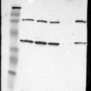 NBP1-85824 - Isocitric dehydrogenase gamma / IDH3G