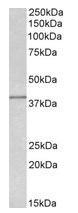 NBP1-78786 - Isocitric dehydrogenase gamma / IDH3G