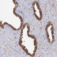 NBP1-85862 - IPP isomerase 1 / IDI1
