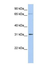 NBP1-57587 - IPP isomerase 1 / IDI1