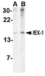 NBP1-76802 - IER3 / IEX1