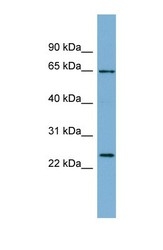 NBP1-52939 - IFFO1