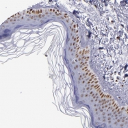 NBP1-83118 - IFI16 / IFNGIP1
