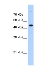 NBP1-56632 - IFI60 / IFIT3