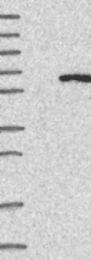 NBP1-87132 - IFIT5