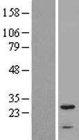 NBL1-11840 - IFITM2 Lysate