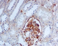 NBP1-95757 - IFITM3