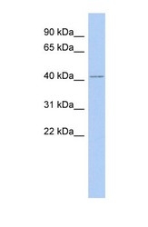NBP1-56726 - IFLTD1