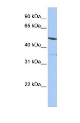 NBP1-52851 - IFRD1