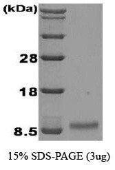 NBC1-18458 - Insulin-like growth factor I / IGF1
