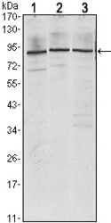 NBP1-51674 - IGF2BP3 / IMP3