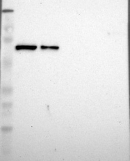 NBP1-84339 - IGF2BP3 / IMP3