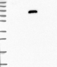 NBP1-89117 - IGFALS / ALS