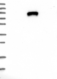 NBP1-89118 - IGFALS / ALS