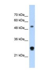 NBP1-59109 - IGSF1 / PGSF2