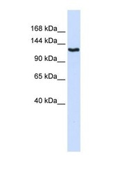 NBP1-59245 - IGSF1 / PGSF2