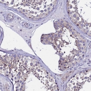 NBP1-92021 - IGSF11 / BTIGSF
