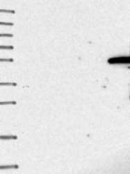 NBP1-92021 - IGSF11 / BTIGSF