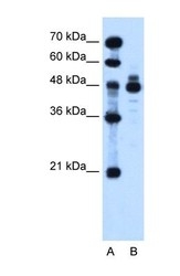 NBP1-59443 - Indian hedgehog protein / IHH