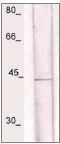 NBP1-74019 - NFKBIA / IKBA