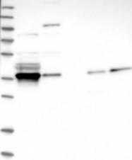 NBP1-87761 - NFKBIA / IKBA