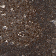 NBP1-87762 - NFKBIE / IKBE