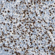 NBP1-89835 - NFKBIZ / IKBZ