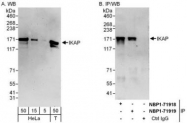 NBP1-71918 - ELP1 / IKBKAP