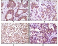 NBP1-47504 - IKBKB / IKKB