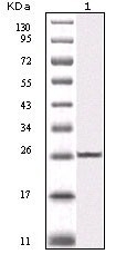NBP1-47504 - IKBKB / IKKB