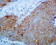 NBP1-95829 - IKBKB / IKKB