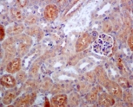 NBP1-95829 - IKBKB / IKKB