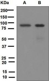 NBP1-95829 - IKBKB / IKKB