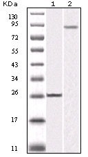 NBP1-47503 - IKBKB / IKKB