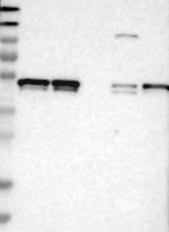 NBP1-84681 - NEMO / IKBKG