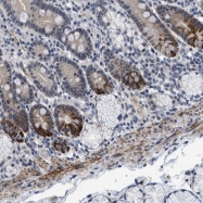 NBP1-82096 - ZNFN1A5 / IKZF5 / Pegasus
