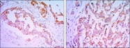 NB100-2184 - Interleukin-1 alpha / IL-1A