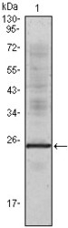 NB100-2184 - Interleukin-1 alpha / IL-1A