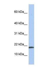 NBP1-58281 - Interleukin-1 alpha / IL-1A