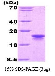 NBC1-18482 - Interleukin-1 beta / IL-1B