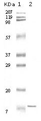 NBP1-47340 - Interleukin-11 / IL11