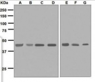 NBP1-96015 - IL11RA
