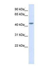 NBP1-62351 - IL11RA