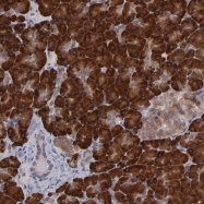 NBP1-85564 - Interleukin-12 alpha / IL12A