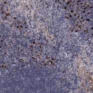 NBP1-84440 - Interleukin-12 beta / IL12B