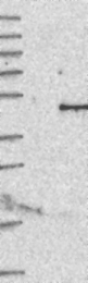 NBP1-84440 - Interleukin-12 beta / IL12B