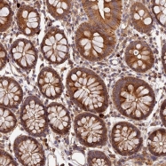 NBP1-89119 - Interleukin-13 / IL13
